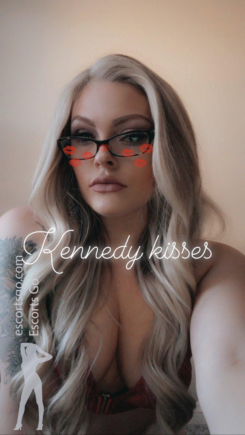 Kennedykisses